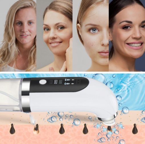 Tire Comédons, Aspirateur d'Acné, Nettoyeur de Pores, Élimination des Boutons, Soin du Visage – Image 6