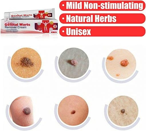 Crèmes anti Verrues Génitales et Condylomes 20g – Image 8