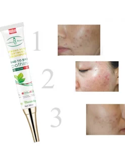 Crème de Traitement de l'Acné, Tâches de Rousseur, Tâches de Pigmentation 30 ml