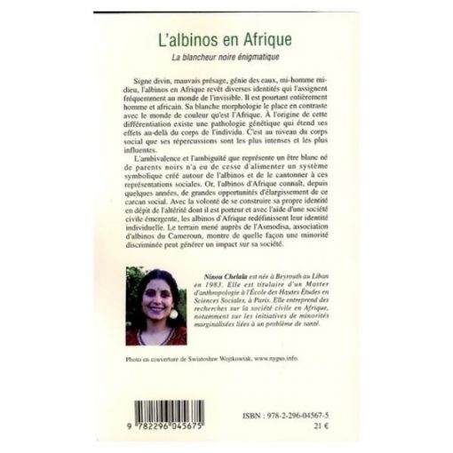 L’albinos En Afrique (La Blancheur Noire Enigmatique) – Image 2