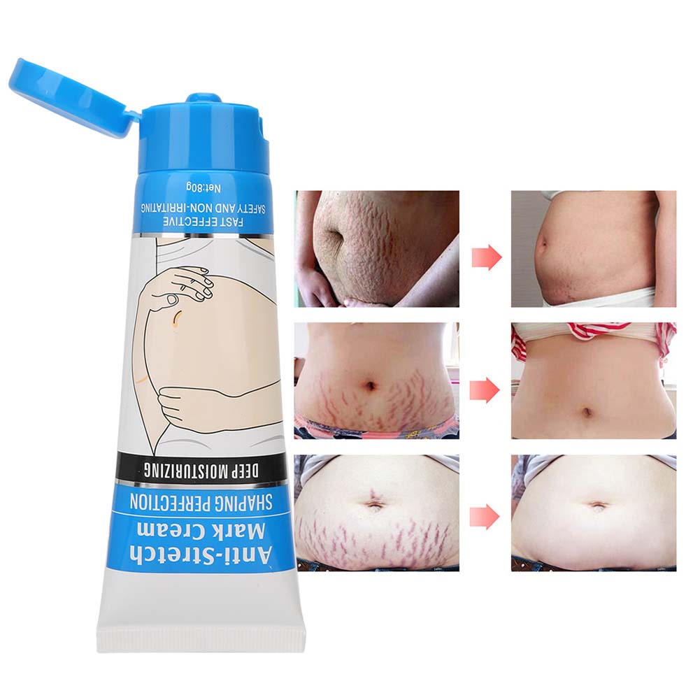 Guanjing Crème Réparatrice, Anti-Vergetures, Rides et Cicatrices 80g