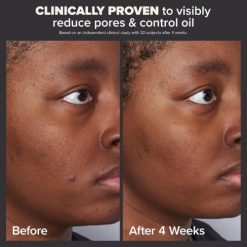 Alternative view of Paula's Choice Skin Perfecting 2% BHA Liquid Scrub, 118 ml